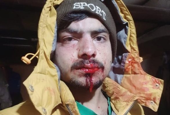 ΕΙΣΑΓΓΕΛΙΚΗ ΠΑΡΕΜΒΑΣΗ ΓΙΑ ΤΟΝ ΞΥΛΟΔΑΡΜΟ ΤΩΝ ΑΛΛΟΔΑΠΩΝ ΣΕ ΚΤΗΝΟΤΡΟΦΙΚΗ ΜΟΝΑΔΑ ΣΤΗΝ ΠΙΕΡΙΑ