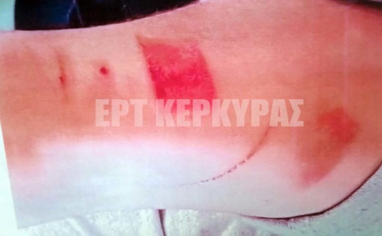 ΑΠΑΡΑΔΕΚΤΑ ΒΑΣΑΝΙΣΤΗΡΙΑ ΣΕ ΣΠΟΥΔΑΣΤΗ ΠΟΥ ΕΚΑΝΕ ΤΗΝ ΠΡΑΚΤΙΚΗ ΤΟΥ ΣΕ ΕΣΤΙΑΤΟΡΙΟ ΤΗΣ ΚΕΡΚΥΡΑΣ