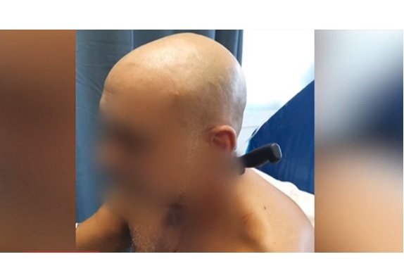 49ΧΡΟΝΗ ΕΜΠΗΞΕ ΤΟ ΜΑΧΑΙΡΙ ΣΤΟ ΛΑΙΜΟ ΤΟΥ 45ΧΡΟΝΟΥ ΚΟΥΜΠΑΡΟΥ ΤΗΣ
