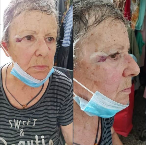 ΧΑΛΚΙΔΑ: ΔΕΧΘΗΚΕ ΕΠΙΘΕΣΗ ΑΠΟ ΠΑΠΑ ΓΙΑΤΙ ΠΗΓΕ ΝΑ ΤΑΪΣΕΙ ΓΑΤΑΚΙΑ