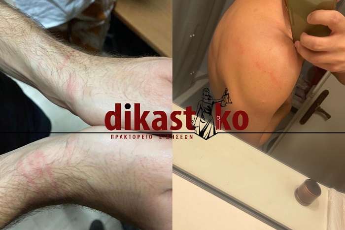 ΑΣΤΥΝΟΜΙΚΟΙ ΧΤΥΠΗΣΑΝ, ΕΔΕΣΑΝ ΜΕ ΧΕΙΡΟΠΕΔΕΣ ΚΑΙ ΠΡΟΣΗΓΑΓΑΝ ΔΥΟ ΝΕΑΡΟΥΣ ΔΙΚΗΓΟΡΟΥΣ