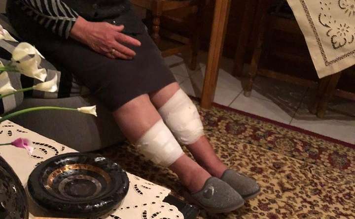 ΣΚΥΛΟΣ ΔΑΓΚΩΣΕ 80ΧΡΟΝΗ ΣΤΟΝ ΤΥΡΝΑΒΟ