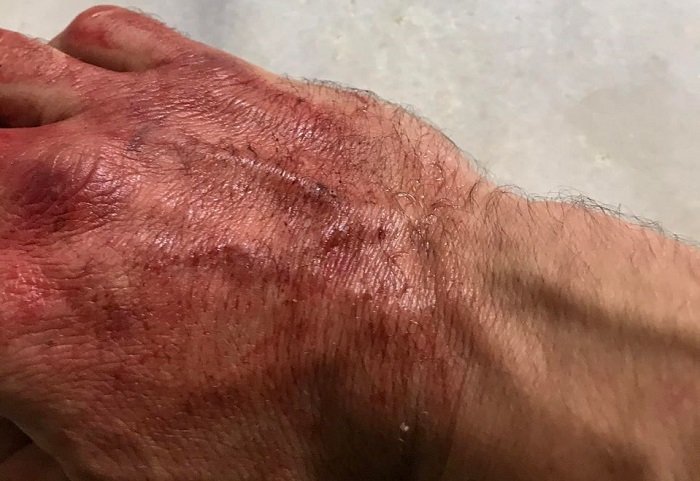 ΧΡΥΣΑΥΓΙΤΕΣ ΧΤΥΠΗΣΑΝ ΑΓΡΙΑ ΜΕΛΟΣ ΤΟΥ ΣΥΡΙΖΑ – Π.Σ.