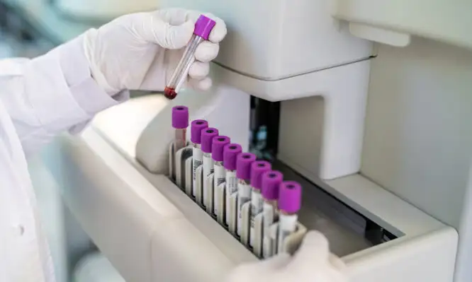 Νέα εξέταση αίματος RNA ανιχνεύει τον καρκίνο και παρακολουθεί την αντίσταση στη θεραπεία