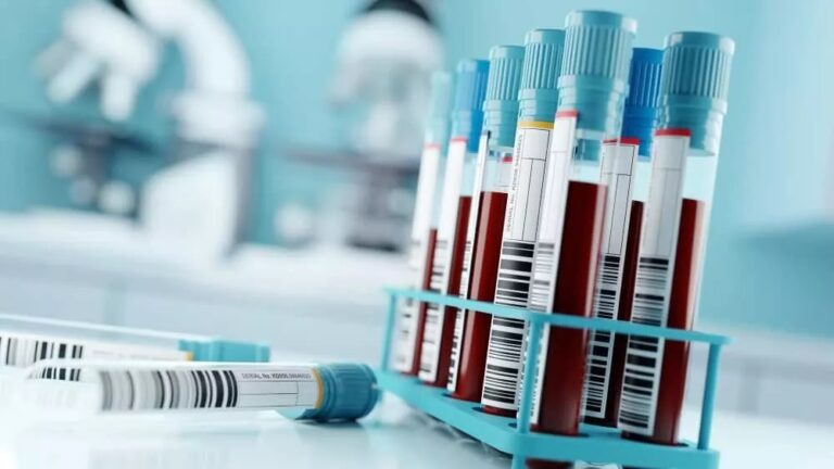 Αιματολογικές εξετάσεις από τα ΚΟΜΥ στον δήμο Τεμπών