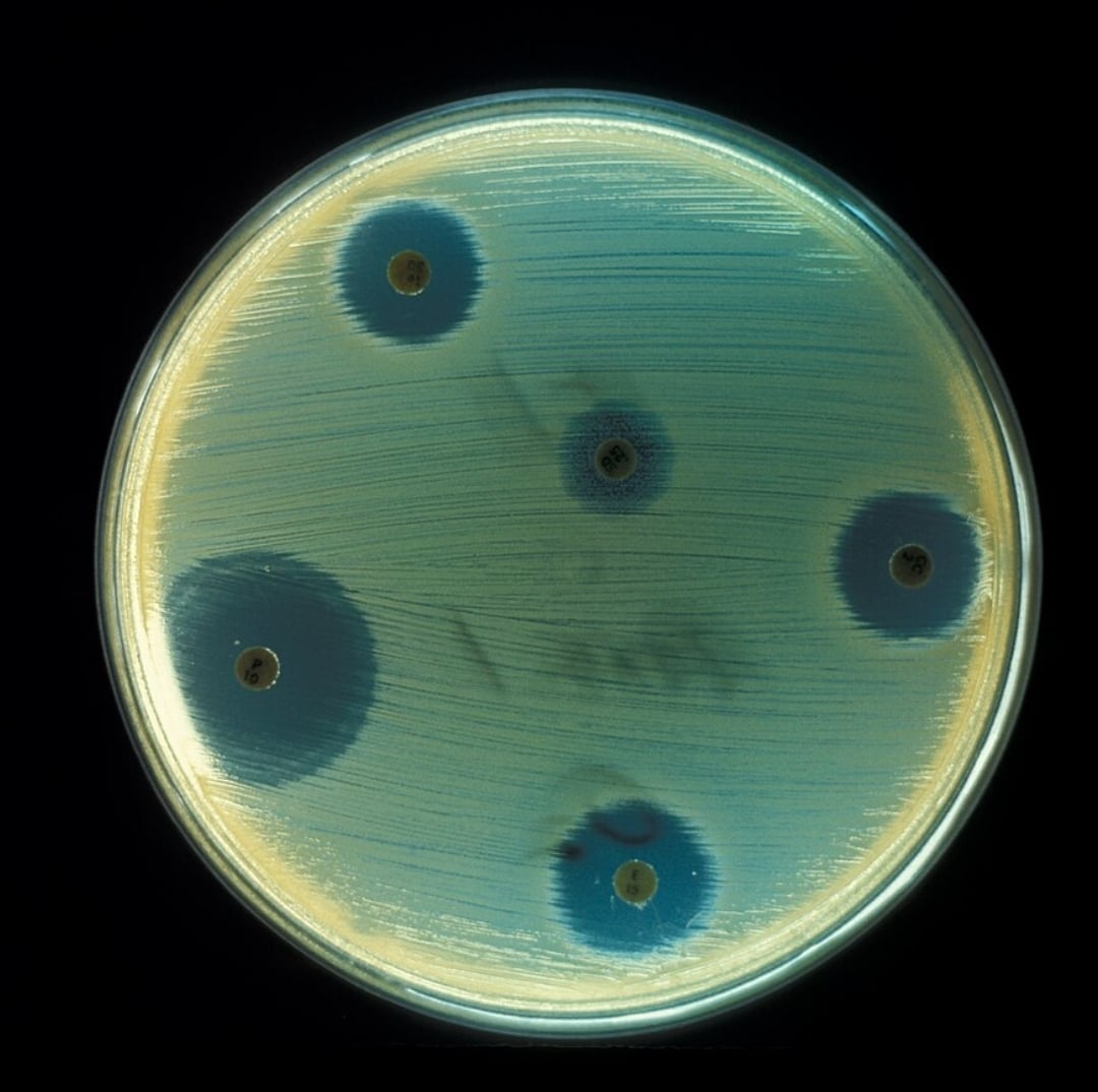 Αντιβιοτικό που “κρυβόταν μπροστά στα μάτια μας” μπορεί να θεραπεύσει επικίνδυνες λοιμώξεις