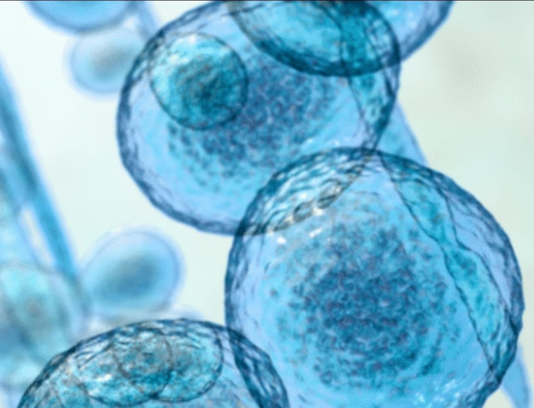 Ο φονικός μύκητας των νοσοκομείων ίσως να έχει ένα «αδύναμο σημείο»