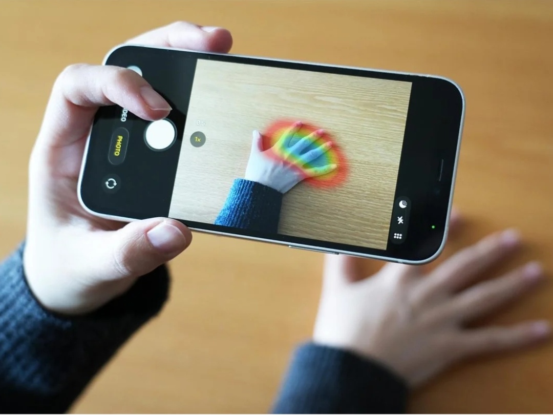 Η Τεχνητή Νοημοσύνη (ΑΙ) εντοπίζει ορμονική διαταραχή που μειώνει το προσδόκιμο ζωής, χρησιμοποιώντας μόνο φωτογραφίες χεριών